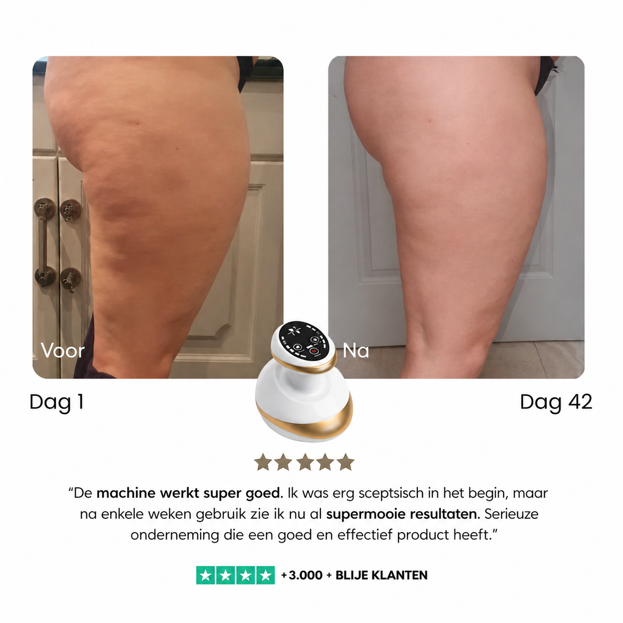 SilkCurve™ – Pro-Sculpt Anti-Cellulitis & Body Contour Massager